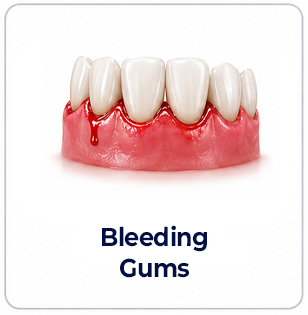dental implants bleeding gums image