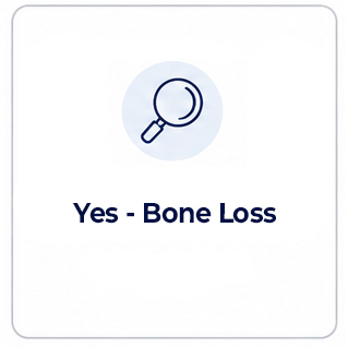 Dental Implant Present Bone Loss