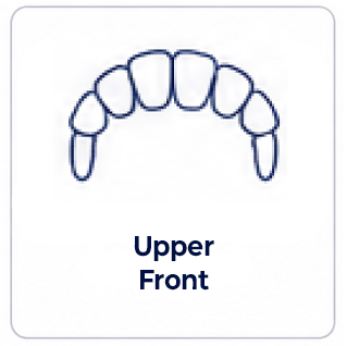 Upper front of mouth dental implant review
