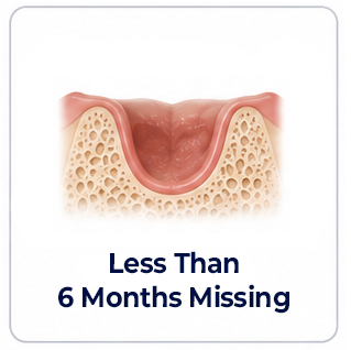 Dental Implants Tooth Missing Less than 6 Months
