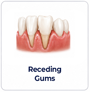 periodontics receding gums image