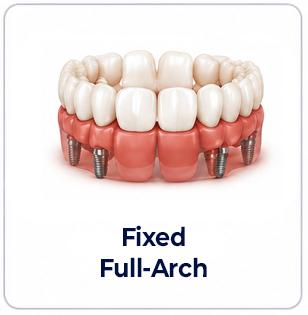 Fixed full arch
