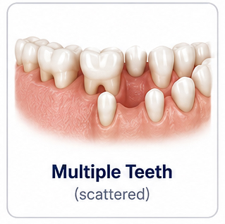Multiple Teeth