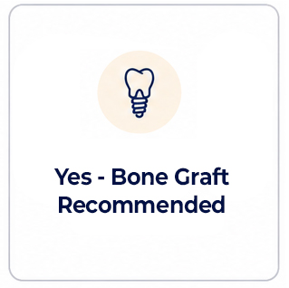 Dental Implant Bone Graph Needed