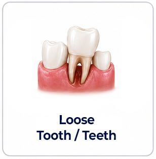 periodontics loose tooth