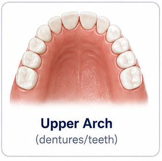 Upper Arch