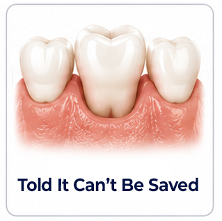 Dental Implants Told It Can't be Saved