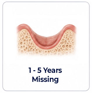 Dental Implants Tooth Missing 1-5 Years