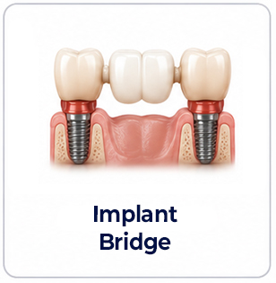 Implant bridges