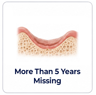 Dental Implants Tooth Missing 5 or More Years