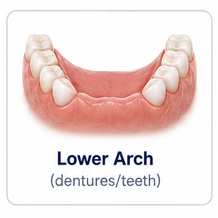 Lower Arch Implant