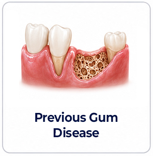 periodontics previous gum disease