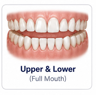 Lower Upper Arch