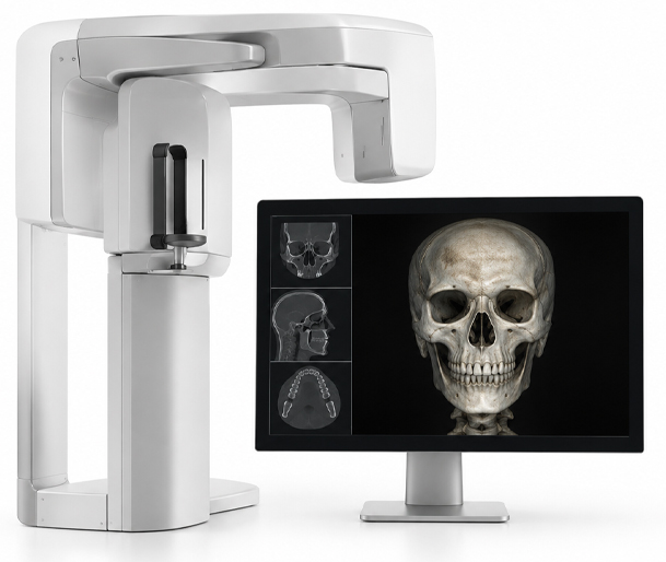 Dental implant 3D dental scan